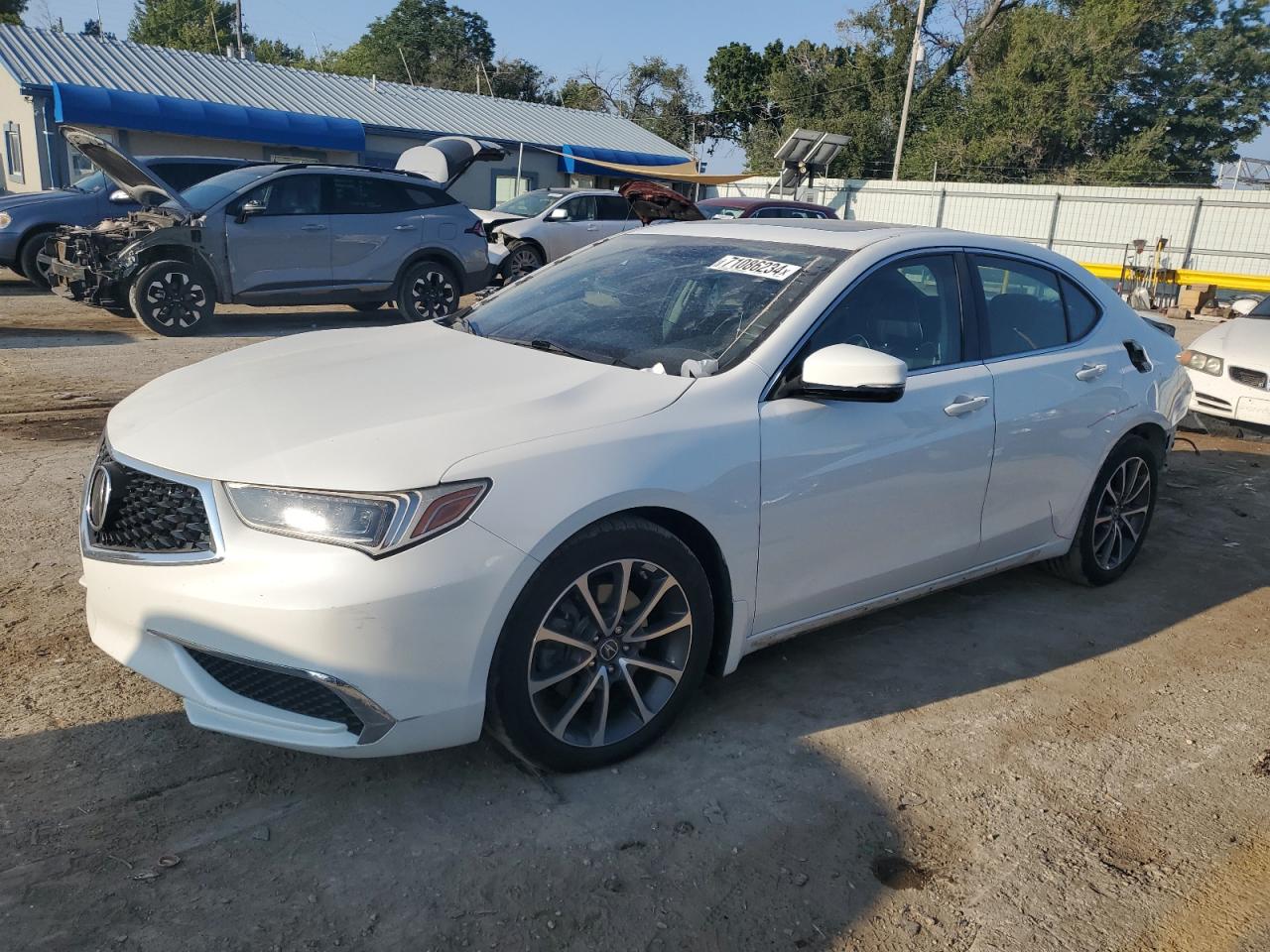 ACURA TLX TECH 2018