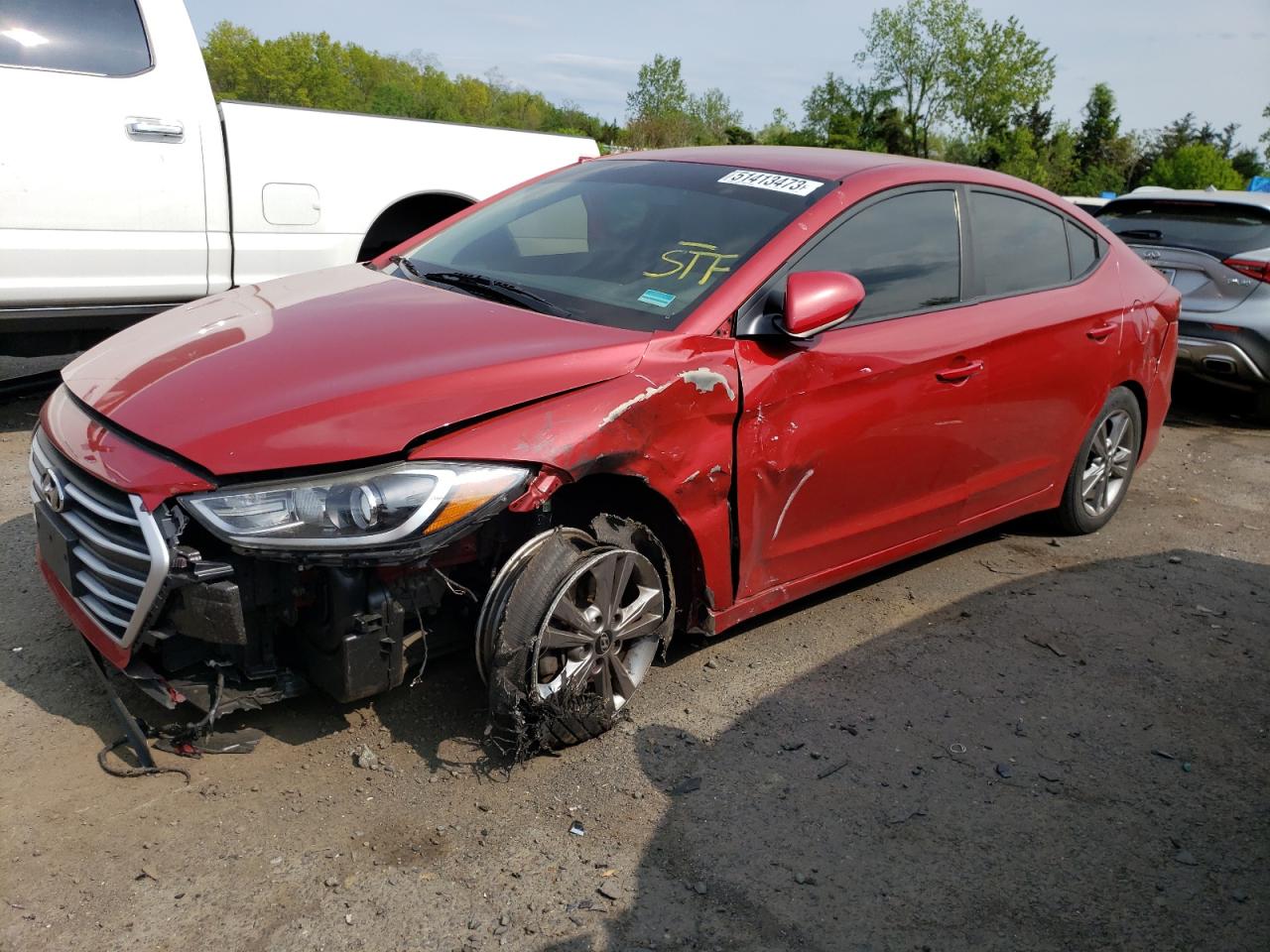 Hyundai Elantra 2017