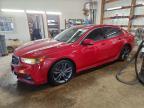 ACURA TLX 2018