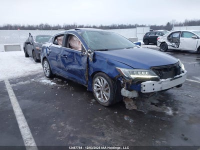 ACURA ILX 2017