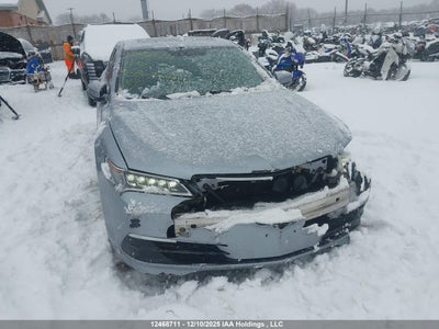 ACURA TLX 2015